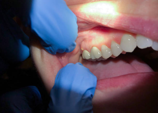 Best Emergency TMJ Treatment in Murphy, TX