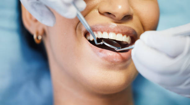 Best Emergency Wisdom Teeth Removal in Murphy, TX